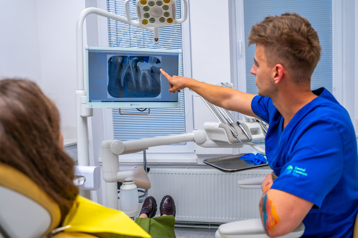 Hlboký zubný kaz | Dental Centrum NIVY