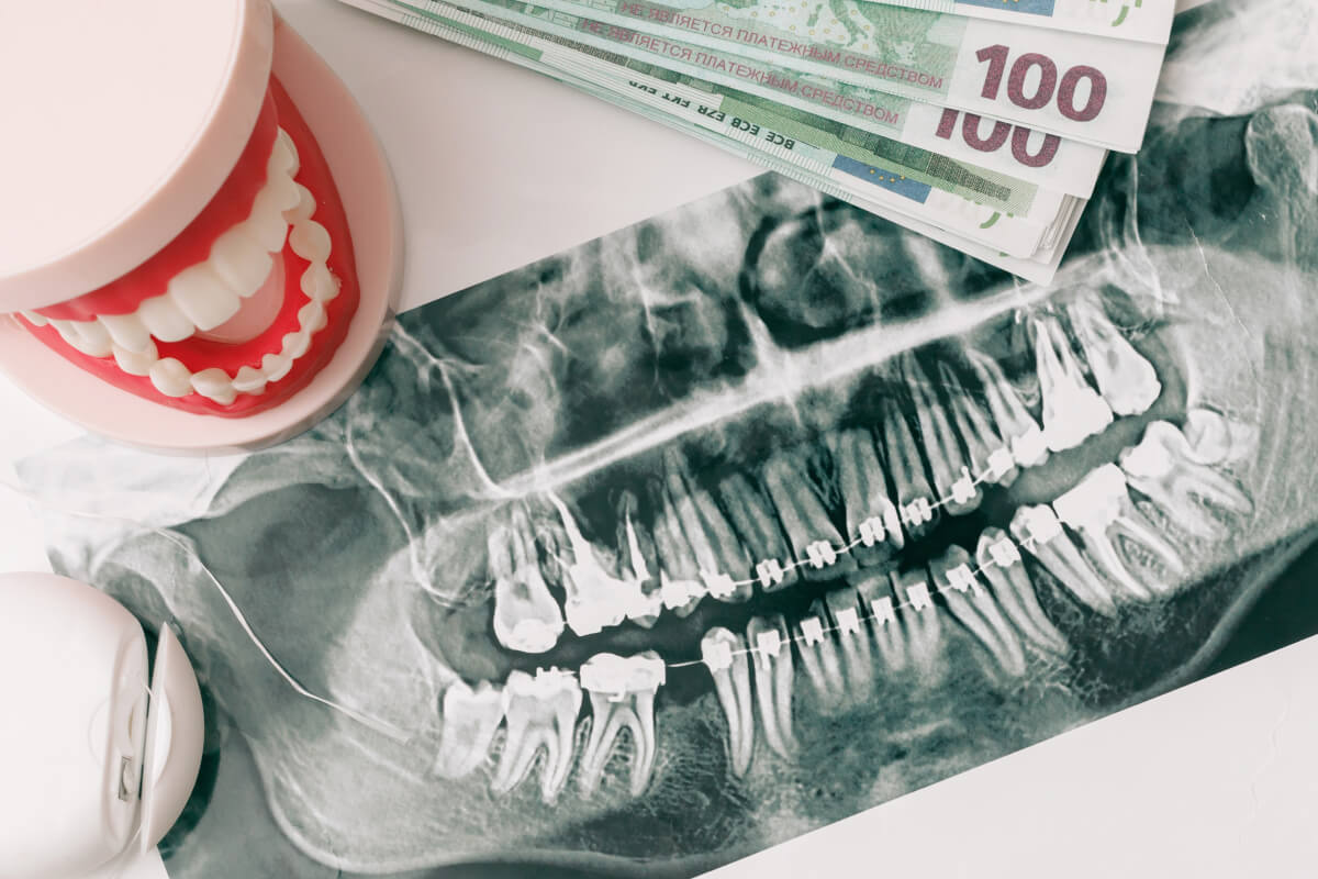 10 tipov, ako ušetriť na zuboch | Dental Centrum NIVY