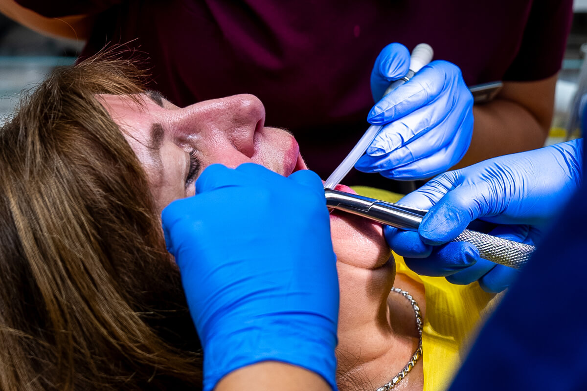Kedy je nevyhnutná extrakcia zuba? | Dental Centrum NIVY