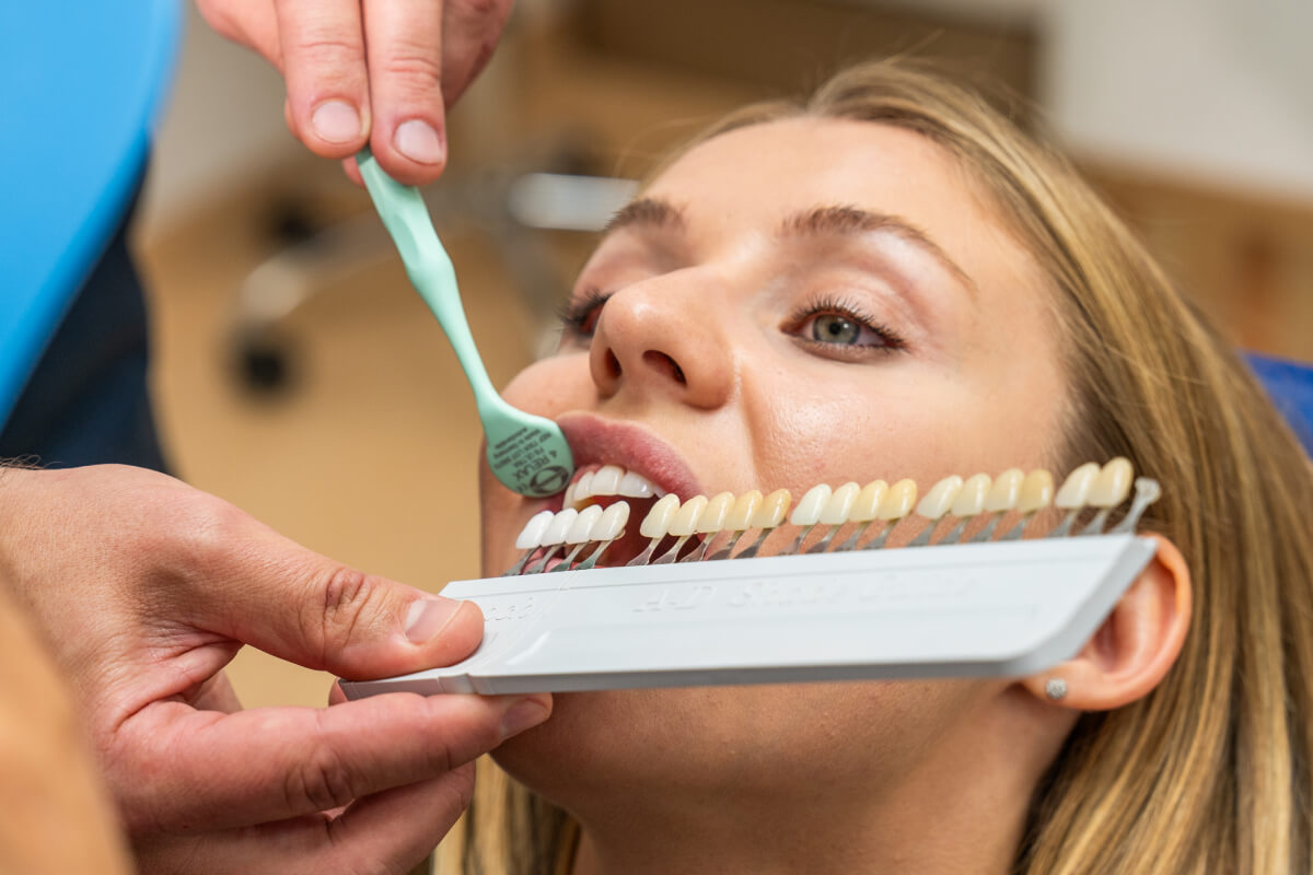 Zubné fazety na počkanie za 2 návštevy | Dental Centrum NIVY