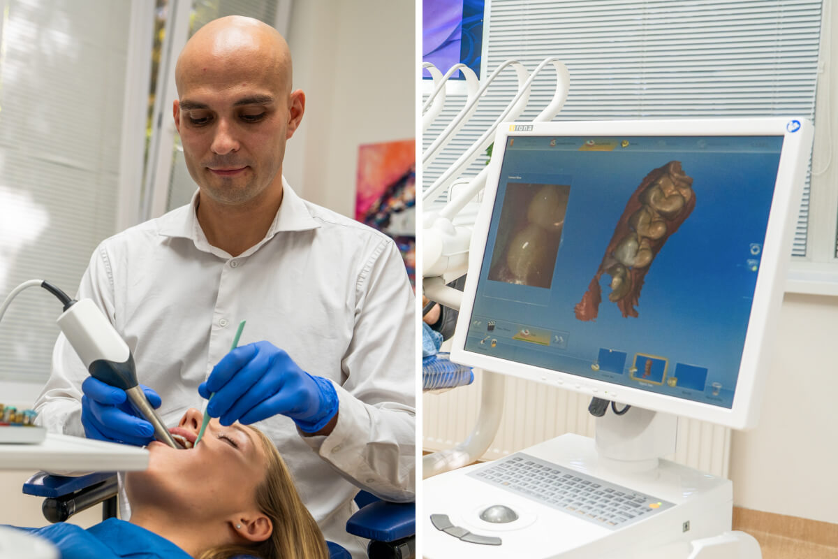 Zubné fazety - aplikácia | Dental Centrum NIVY