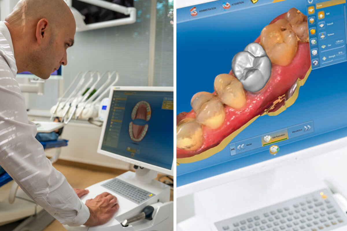 CEREC® korunka na zuby - počítačový návrh | Dental Centrum NIVY