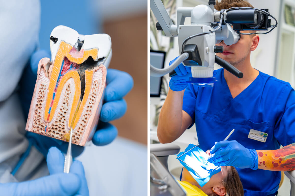 Endodoncia - posledná šanca na záchranu zuba | Dental Centrum NIVY