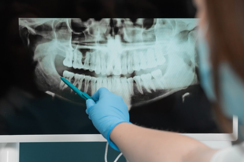 Je zubný röntgen nebezpečný? | Dental Centrum NIVY