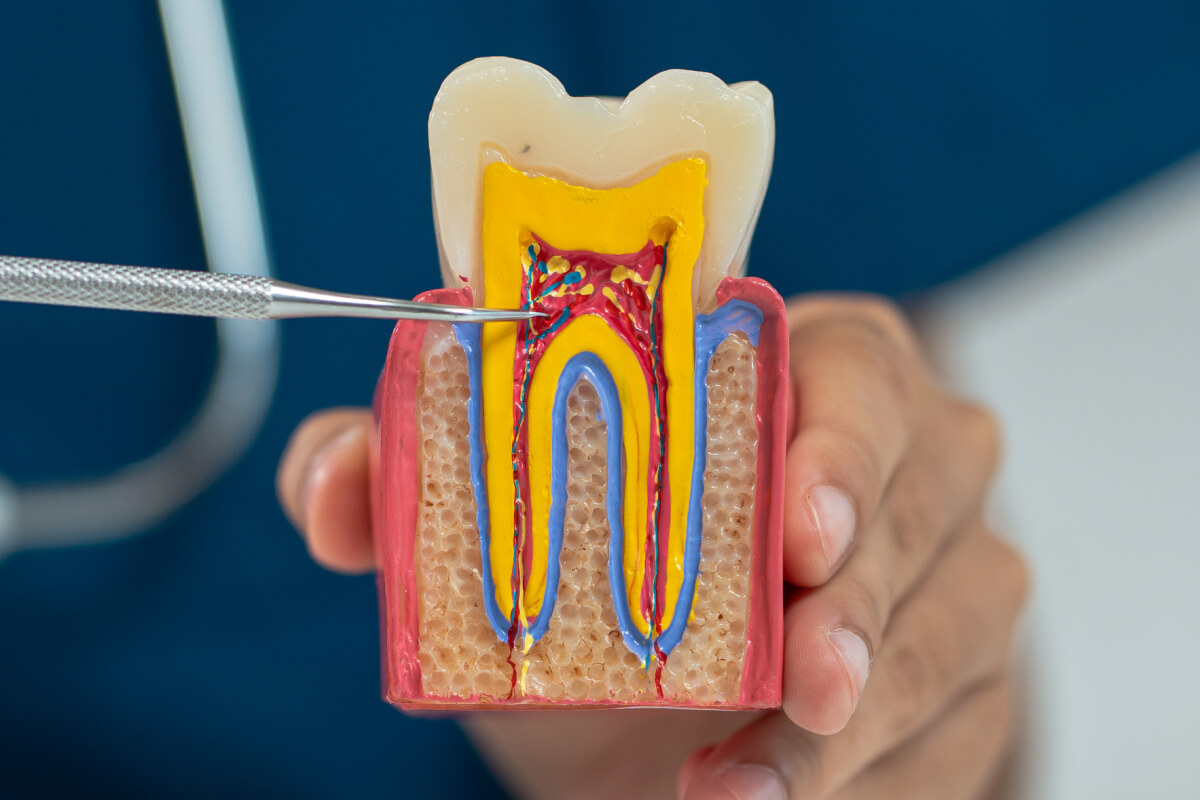 Poškodenie nervov po extrakcii zuba | Dental Centrum NIVY